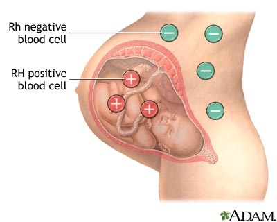 rh negative immune to diseases