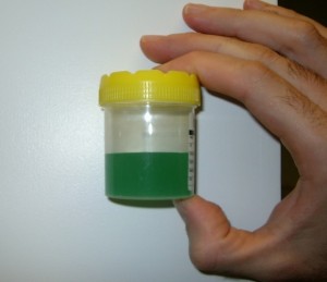Green-Urine-008